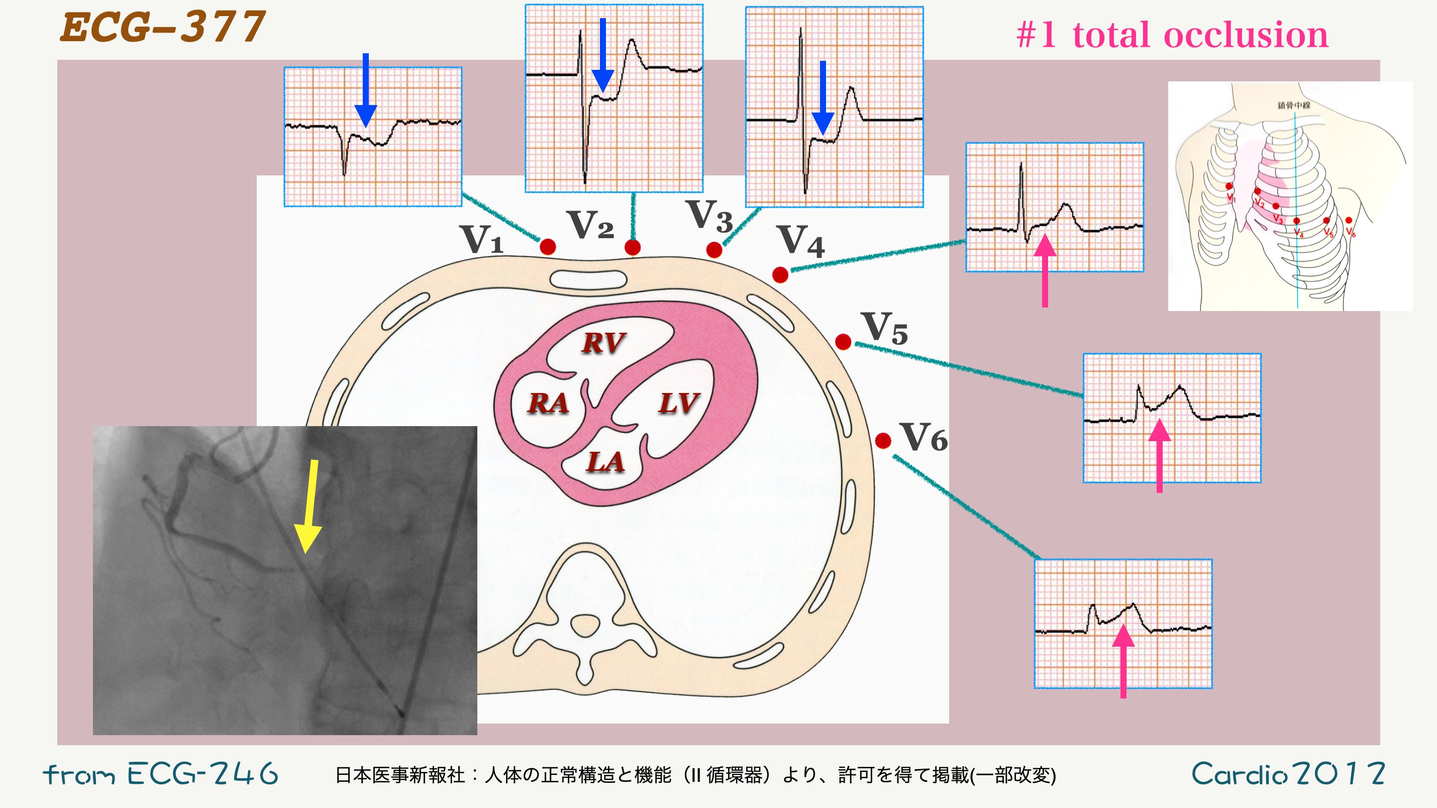 N. Tsukishima EP大学心電図検定学部試験対策科担任 على X