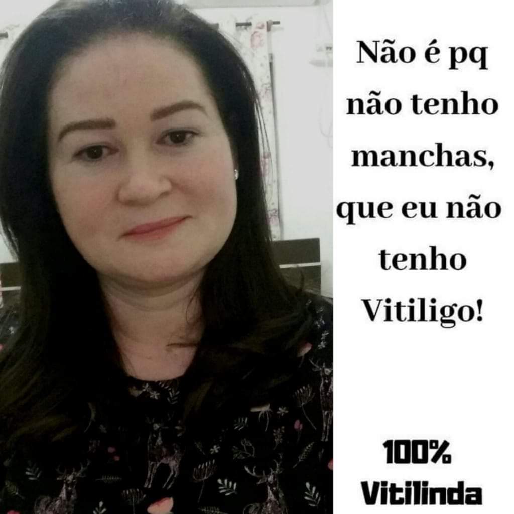 MiguelHe12's tweet photo. Oi gente, eu amo demais minha mãe e queria saber se posso contar com vocês, ela está fazendo uma campanha por conta do vitiligo, ficaria muito feliz se vocês pudessem ajudar dando RT, isso é muito importante pra ela e para mim... https://t.co/WOjcEDVh3X