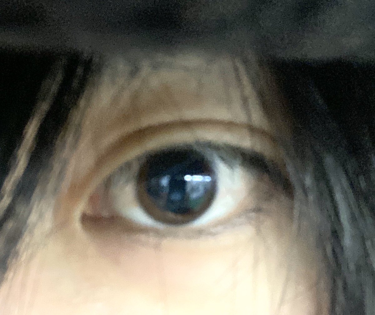芝ｗｗｗ健ｗｗｗ アナタシア ｗｗｗ 右目の検査してもらってついでに見えてる方の左目も診てもらったんだけど検査の効果で 瞳孔開いてるのすごくない ｗｗｗｗｗｗｗｗｗｗｗｗｗｗｗｗｗｗｗｗｗｗ 黒目で茶目が結構消滅した D D D
