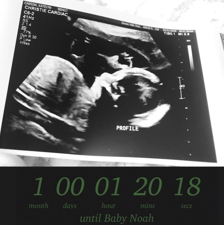 KKlayer's tweet image. 1 MONTH FROM TODAY NOAH WILL BE BORN😍💚🥺 WHAT?!?!?!