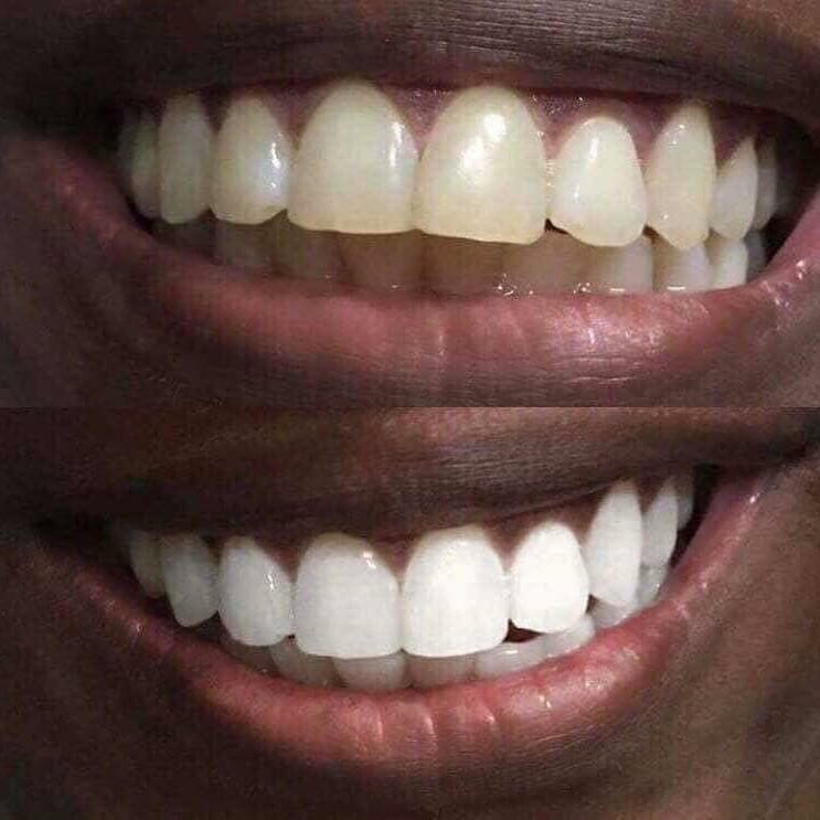kaMazibukoBusi's tweet photo. With dazzling whiter teeth, you will smile with Confidence
AP24 Whitening Toothpaste brightens and whitens teeth while fighting plaque formation ๐
Price: R160 | Delivery: R60
WhatsApp 0714135429 to order
#MyPostLockdownSA
Unathi https://t.co/q4QoHrAkGd