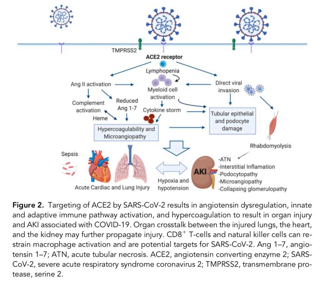 El DAÑO RENAL AGUDO por COVID-19 🦠 está mediado por:

•daño directo del virus
•tormenta citocinas
•activación AngII
•disregulación de complemento
•hipercoagulabilidad
•microangiopatia trombótica

JASN 31:2020. doi: doi.org/10.1681/ASN.20…