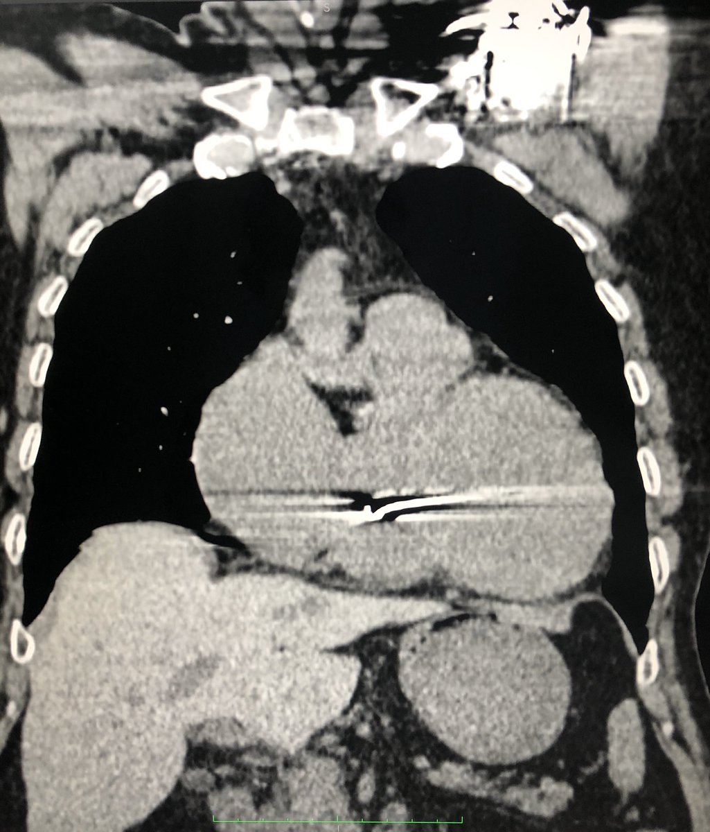 DrChinkyChatur's tweet image. Because, who doesn’t love the good old elementary spotters!
#DailyReporting #ImagesinRadiology #Spotter 
@drankitbalani