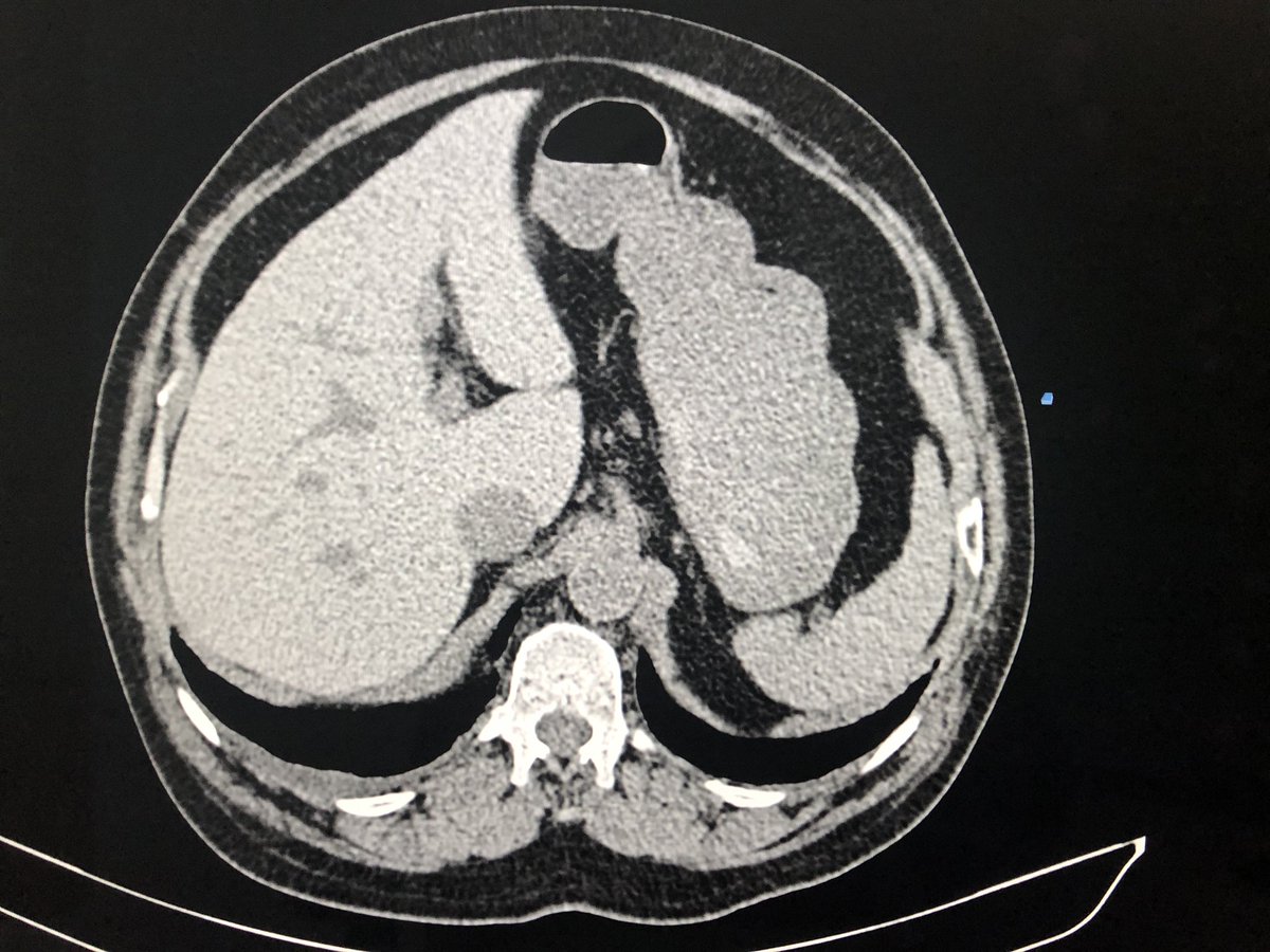 DrChinkyChatur's tweet image. Because, who doesn’t love the good old elementary spotters!
#DailyReporting #ImagesinRadiology #Spotter 
@drankitbalani