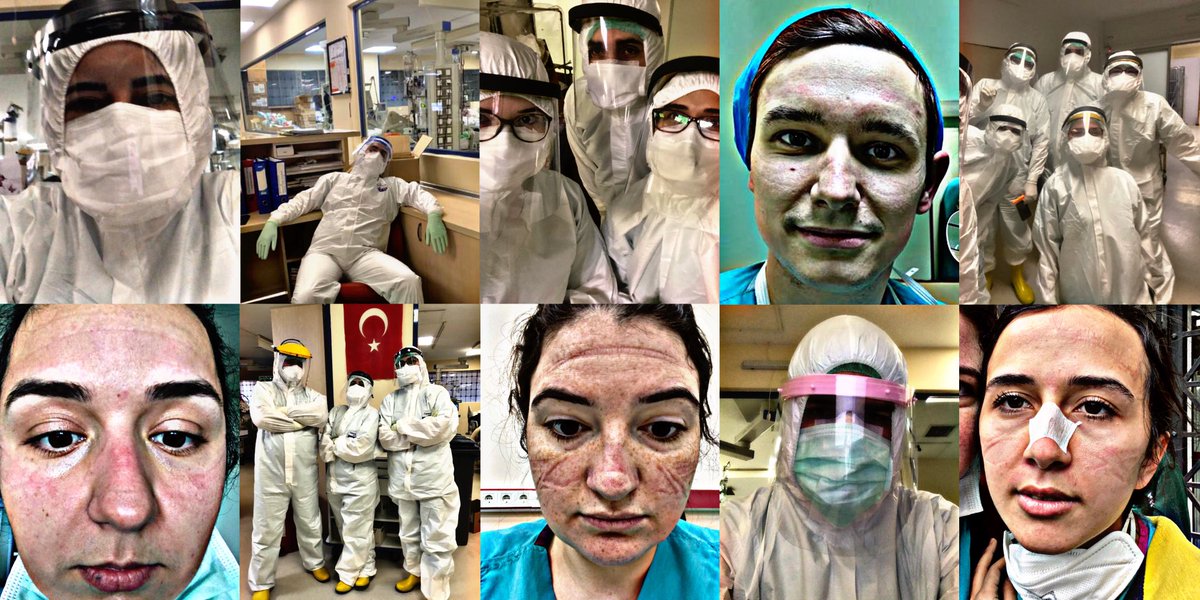 dilanbuyuk's tweet photo. İşimizin başındayız. Çalışmaya devam ediyoruz. Farkımız yok hepimiz aynıyız. #sözünüzütutun #üniversitelereşitlikistiyor @drfahrettinkoca @BeratAlbayrak @fatihportakal @doktorlarsitesi @saglikbakanligi https://t.co/BxzTA67grv