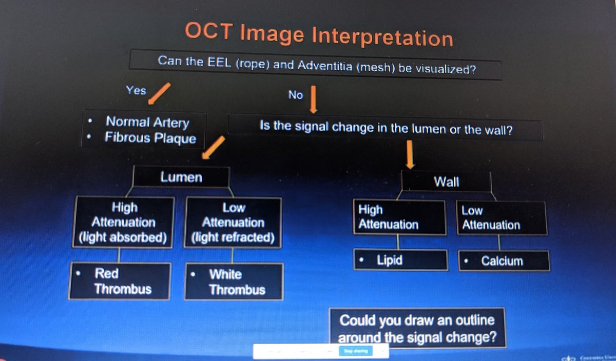 aayshacader's tweet photo. Step-by-step #WhyOCT talk @ziadalinyc @C3_Academy 
🔸OCT image interpretation
🔸Pre-PCI: strategize/morphology-guided lesion prep
🔸Post-PCI:optimize: stent apposition vs expansion
@DrJayMohan @Tabaza @rachkataria @mirvatalasnag @yaqoub_lina  @ShrillaB @afm_cardio @cardioPCImom https://t.co/lyL4k5rIhS