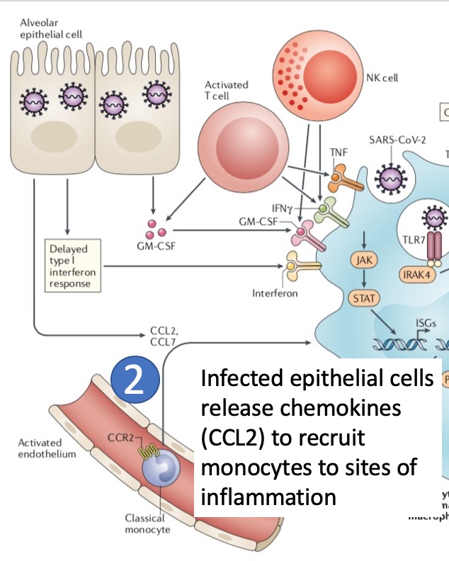 (2) Infected lung cells (eg., type 2 pneumocytes) release chemokines (e.g., CCL2) that bind to CCR2 on the surface of monocytes in blood and recruit these cells to sites of inflammation, where monocytes differentiate into macrophages.