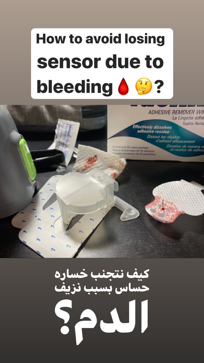 أحيانًا نركب السنسر ويطلع دم أثناء التركيب. الحل في هذا الموقف هو: 
١- وضع قطعة قماش ناشفه فوق الحساس لمدة ٣ دقائق 
٢- اذا ما وقف الدم، يتم تغييره لأنه النزيف راح يأثر على مستشعر الحساس لقراءة الجلوكوز من السائل الخلوي

لتلافي هذا الموقف من البداية، هناك احتياطات مساعده👇🏻
