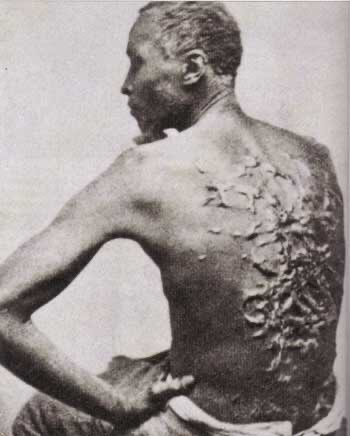 Article 15 du Code Noir : Les esclaves qui sont en possession d’armes ou de gros bâtons risquent de recevoir des coups de fouets ( par centaines ). Voici une image d’un esclave après diverses coups de fouets.
