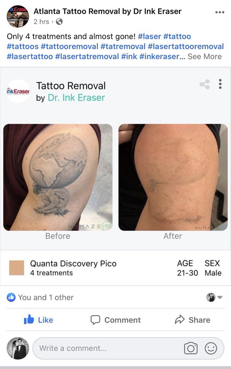 HumazeMD's tweet image. Post Before &amp;amp; After outcomes directly to all your social media accounts from the HumazeMD app.
- B/A Website integration
- Social media posting
- Custom QR code link
 #socialmedia #website  #socialstrategy #socialmediamarketing #digitalmarketing #plasticsurgery #aesthetics