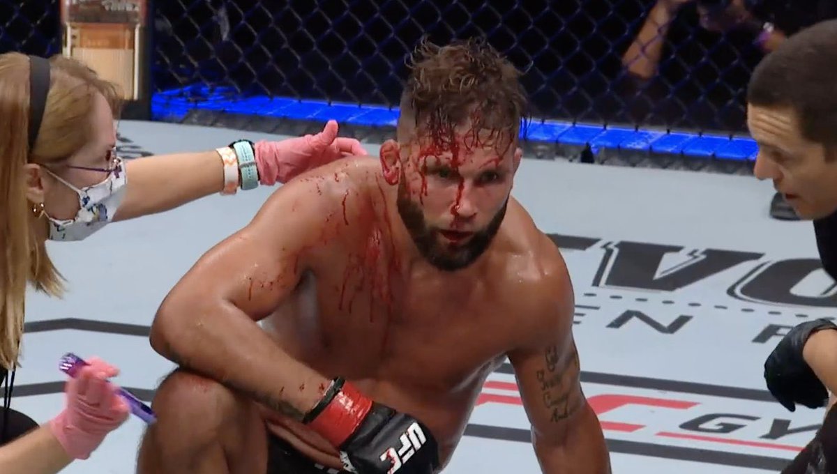 NBCSFights's tweet photo. 😬😬😬 https://t.co/kmkvc8yuwi