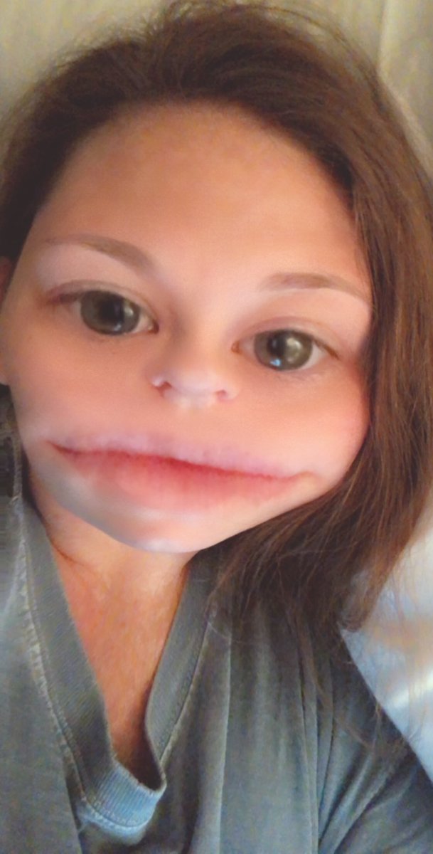 alwilli7's tweet photo. No I haven’t had my lips done please stop asking https://t.co/AEJ8Oulibp