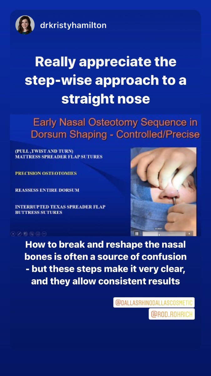 DrRodRohrich's tweet photo. #rhinoplasty correction of the #deviatednose @DrRodRohrich @DallasRhino https://t.co/CE4M3jKqpB