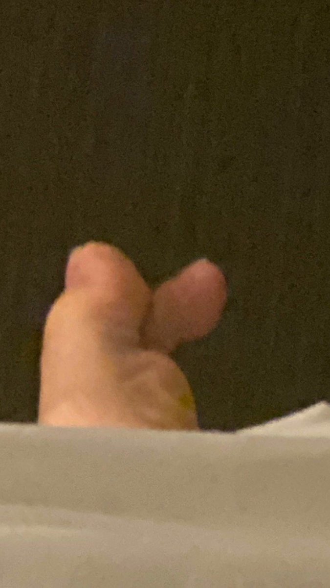 harumaner's tweet photo. t-taehyungie toe bunny? https://t.co/GCezGjGt7g