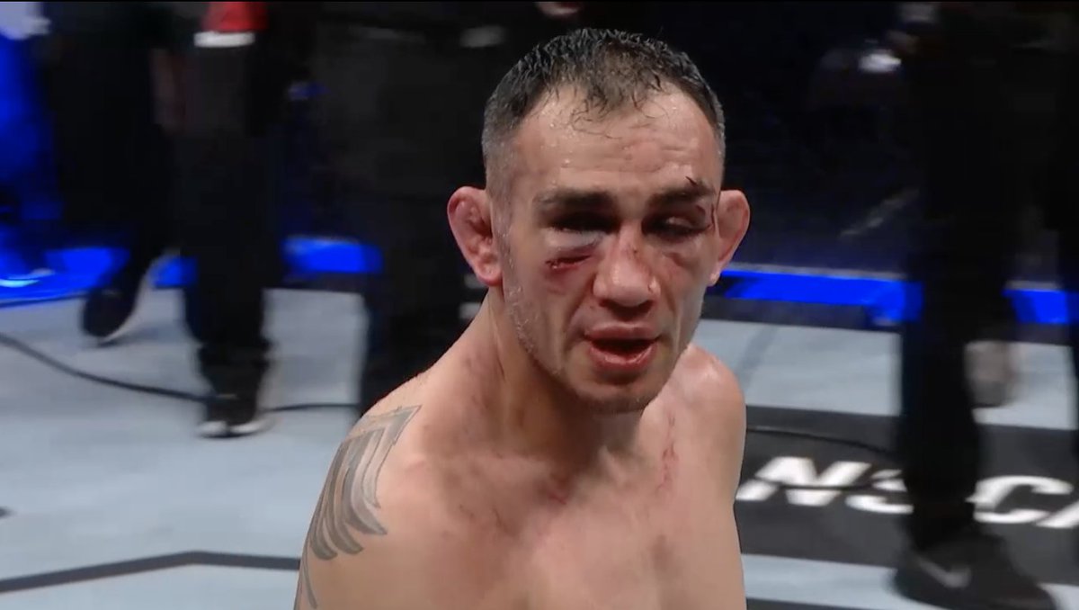 Justin Gaethje did damage to Tony Ferguson 🥴

#UFC249