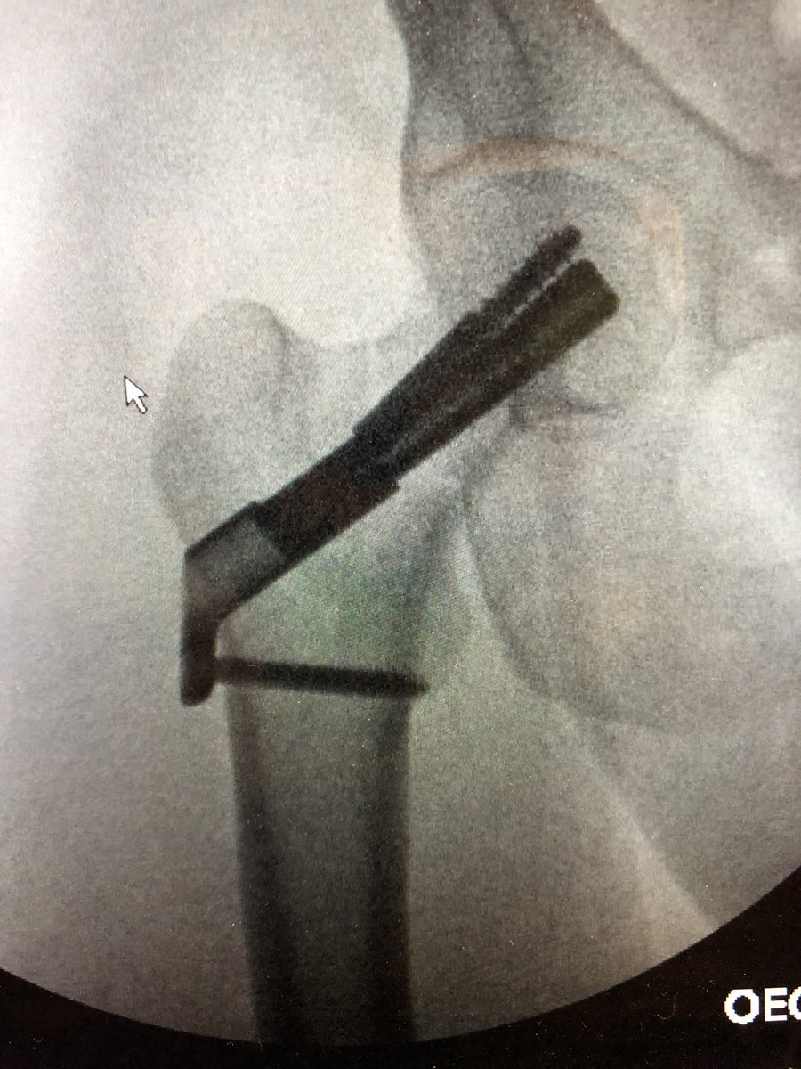 Greg Osgood tweet media