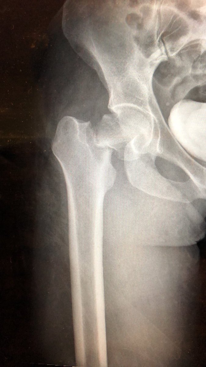 Greg Osgood tweet media