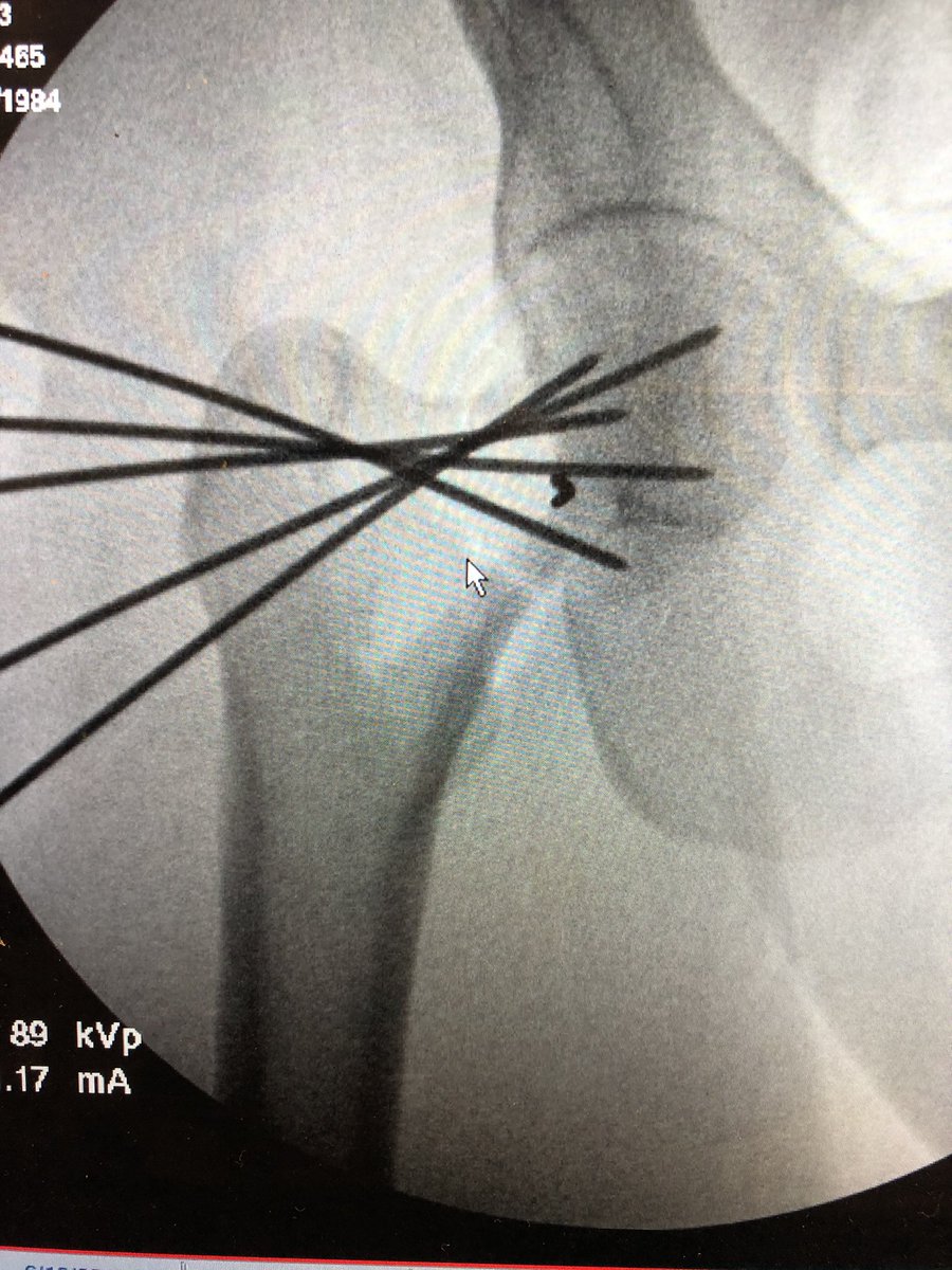 Greg Osgood tweet media