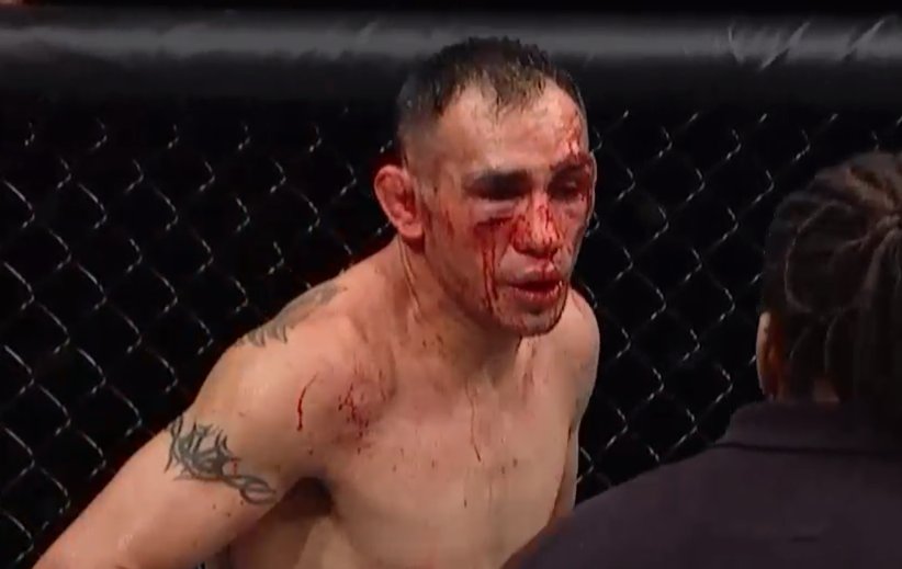 zimanshu's tweet photo. The only one who can make any one look like that is @TonyFergusonXT himself, looks like tony fought himself #UFC249 https://t.co/DGl6A5yjby