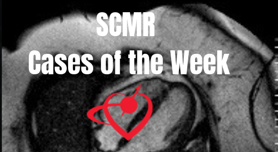 SCMR posts interesting, educational CMR Cases of the Week. Check out our 10 year repository! #WhyCMR scmr.org/page/caseofthe…