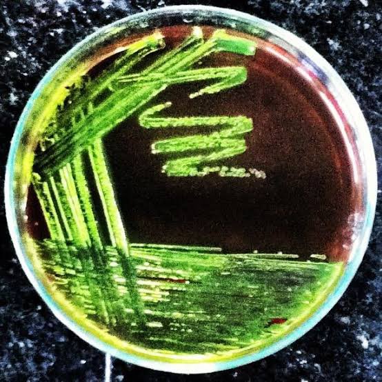 AkoSiQueenB's tweet photo. Kasama nating nagdiriwang ng #HappyMothersDay2020 ang mga #fecal #coliforms dahil sa lumalagablab na #heatindex of 43C (E. coli on EMB, photo not mine) https://t.co/CHMbQLG1z0