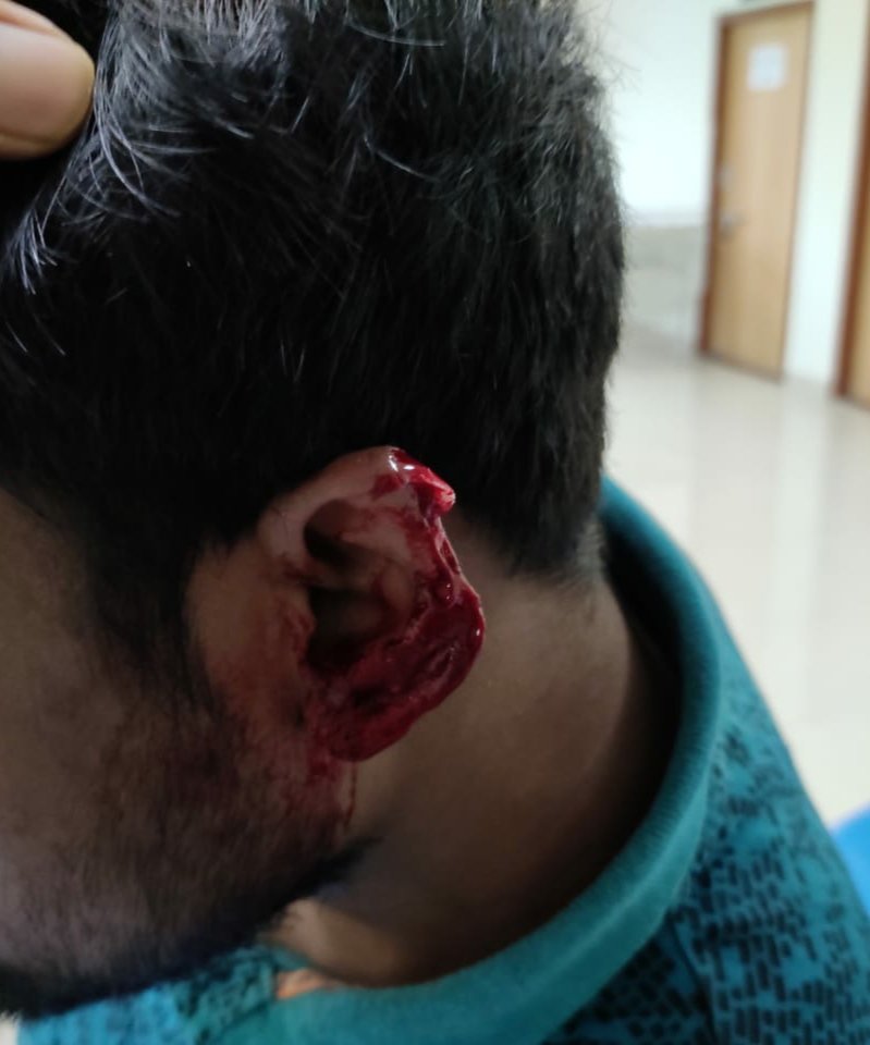 JdaMkcg's tweet photo. Inhumane and dastardly attacks on doctors are touching new low everyday!
An onduty junior doctor was attacked by patient attendant while discharging his duty.
@CMO_Odisha @Ganjam_Admin @HFWOdisha @nabadasjsg @Naveen_Odisha @kanak_news @Kalingatv @NEWS7Odia @otvnews @sp_ganjam https://t.co/8j5mNUQrRe