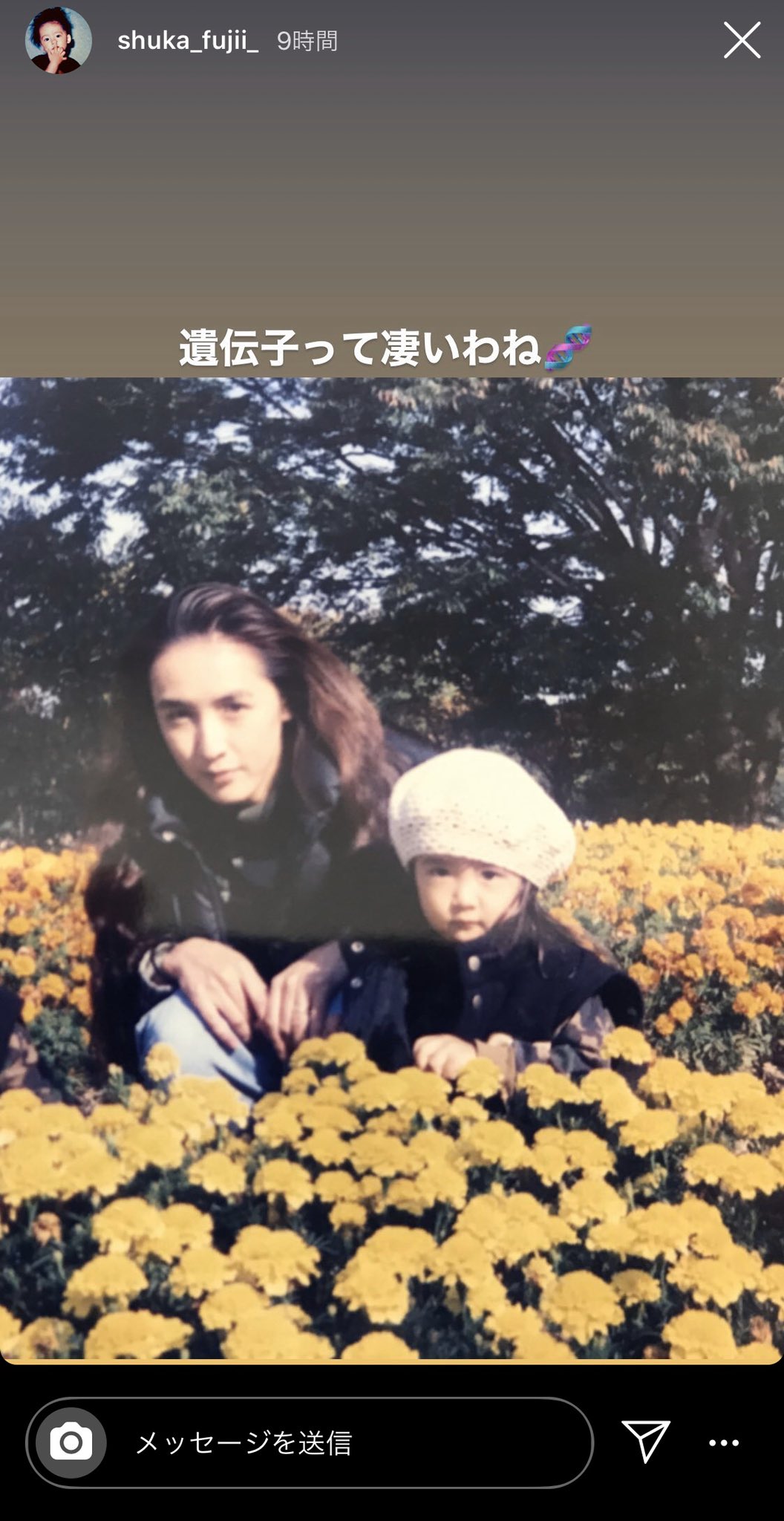 Miz 萩花ちゃんのインスタのストーリーに 萩花ちゃんママと 小さい頃の萩花ちゃんの 写真が載ってたんたけど 一瞬 ロン毛の流星くんかと思った てか美人すぎるし 可愛すぎる 藤井流星 藤井萩花 藤井夏恋 T Co Tx0dy21k1t