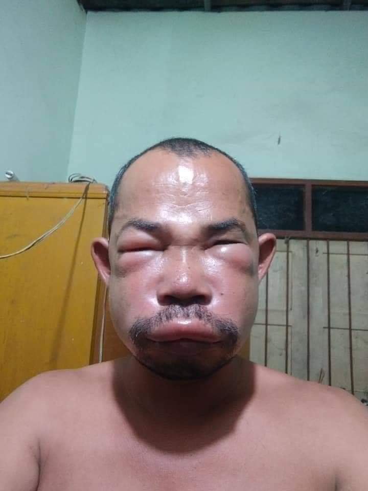 Chinese man beaten in Kilimani for deliberately coughing in the face of a security guard. #covid19kenya #COVIDIOTS President Uhuru Kenyatta,  Itumbi,  David Murathe