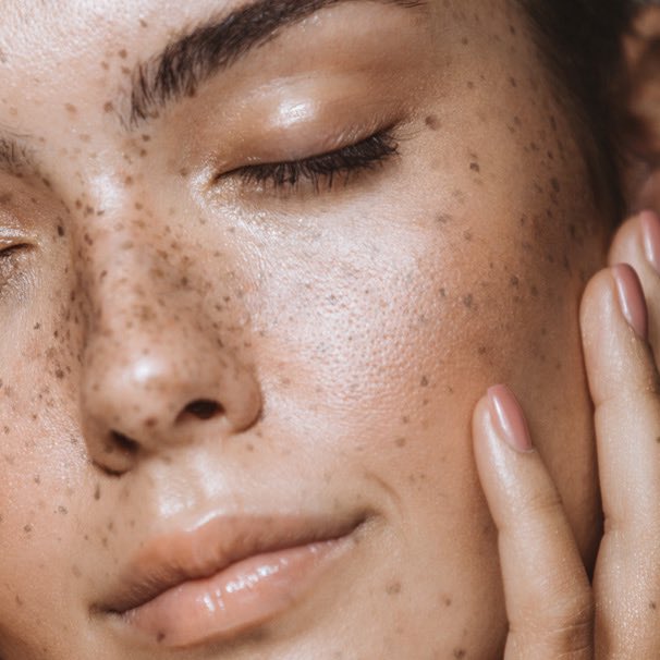 Most Requested Skincare Questions Answered