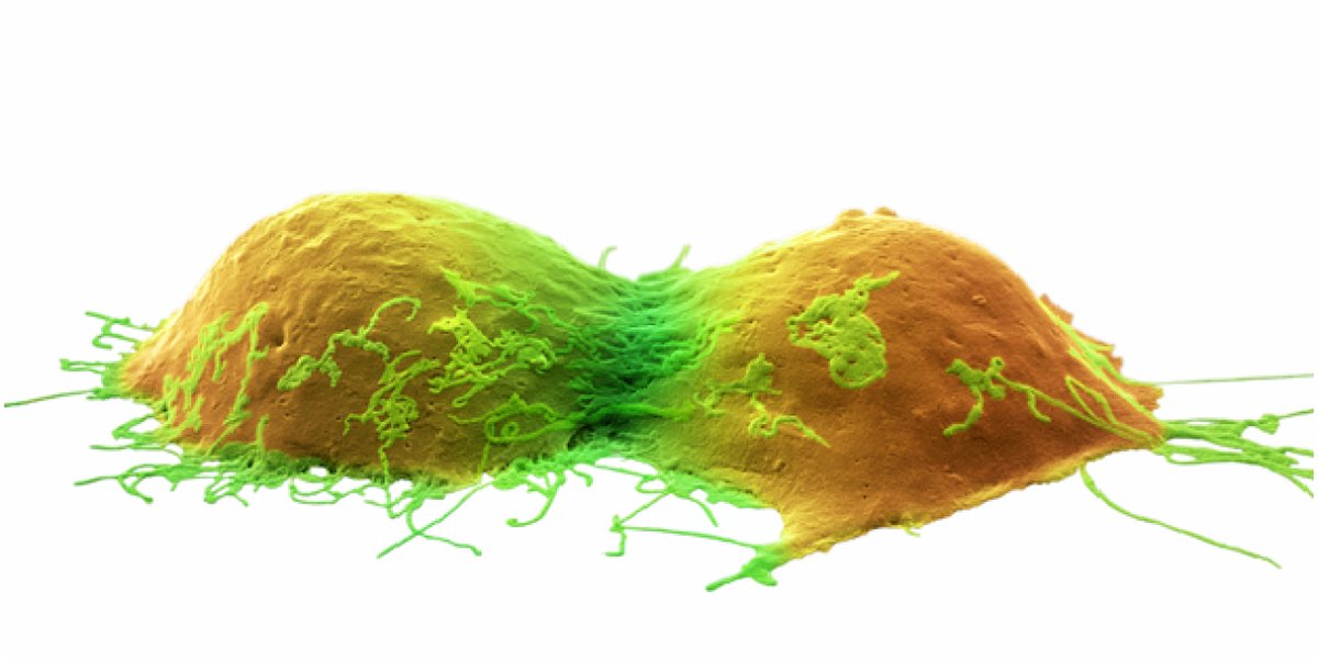 New paper in <a href="/MolPharmJournal/">Mol Pharm (ASPET)</a>: Molecular Envelope Technology - first demonstration of highly concentrated subcutaneous formulations with hyaluronidase coated nanoparticles. Encapsulated CUDC-101 successfully suppresses pancreatic cancer in tumour models. bit.ly/3cg35pDon