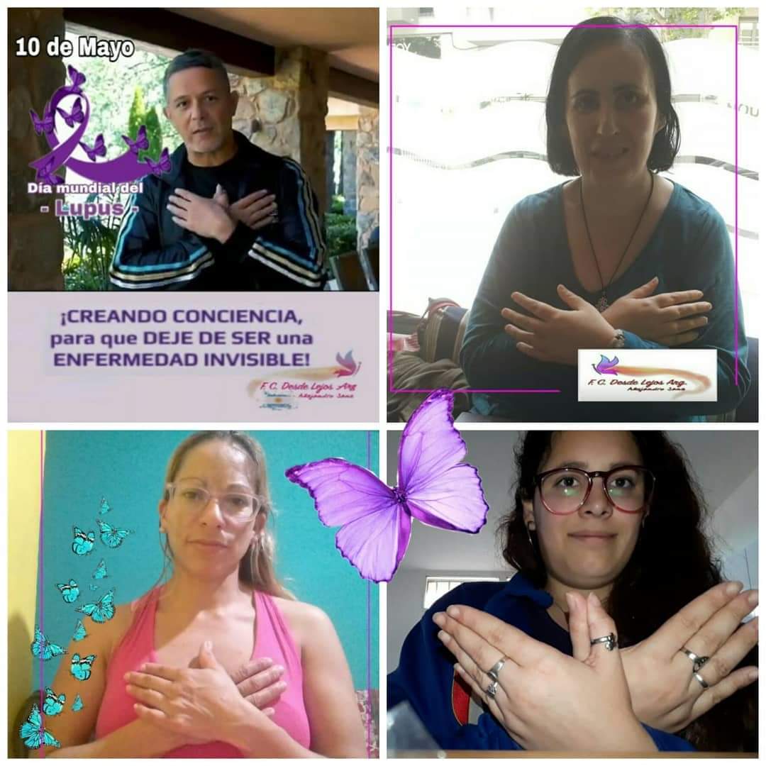 fcdesdelejosarg's tweet photo. Hoy es el #DíaMundialDelLupus 
Junta tus manos por el Lupus 👐 hazte una foto/vídeo y súmate al #RetoMariposa 🦋
@Felupus 
Reto a @azumir para que se unan conmigo en esta campaña
#InvisibleParaTodosMenosParaLosQueLoPadecen
@AlejandroSanz 
@LFdCesmas https://t.co/PYsdSpC4E5
