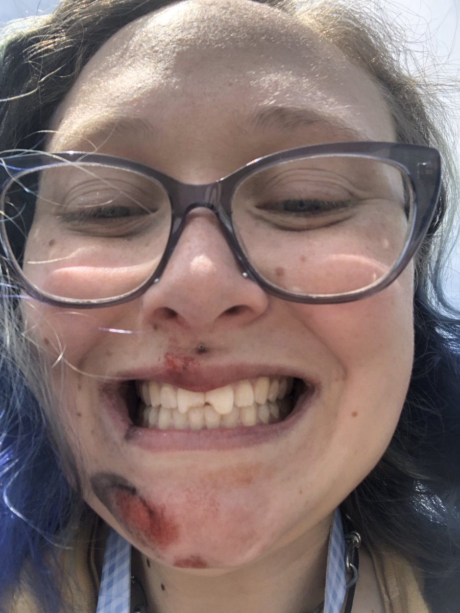 techno_nun's tweet photo. PayPal is violetviolence98@gmail.com , I’d be #papablessed to get this money... my boyfriend and I got hit by a car yesterday and I gotta replace my two week old, totaled scooter🥴 https://t.co/ZtOUW4mgPm