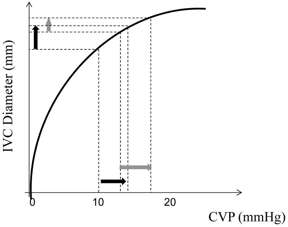 Abdominal IVC size depends on the difference between CVP and IAP. At a constant IAP, IVC size will increase proportionally to CVP until it reaches the flat part of it's compliance curve. (Great thread by  @Thind888 here:  https://twitter.com/Thind888/status/1249591199624769540?s=20) (3/17)