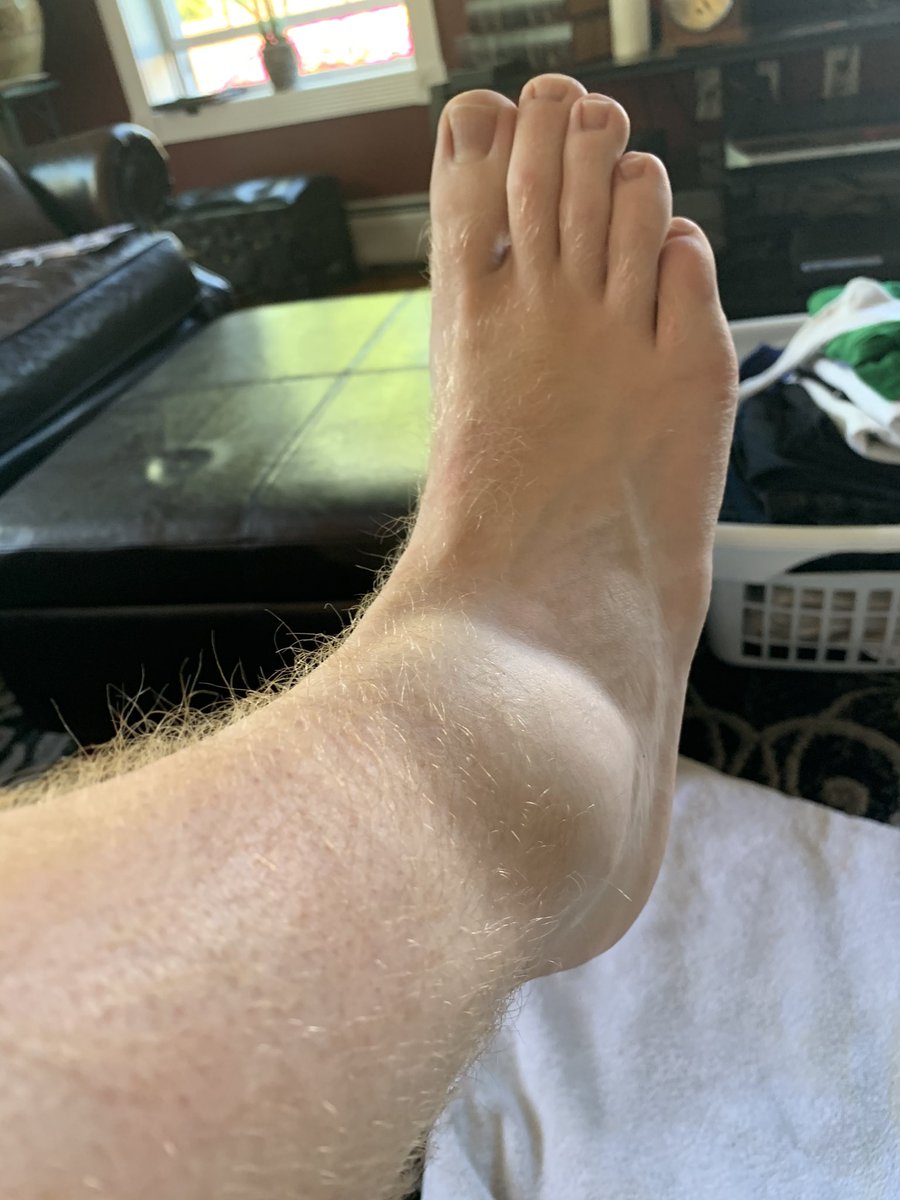 jduffypr's tweet photo. Minor setback for a major comeback #IWillBeBack https://t.co/KqblTTBbll