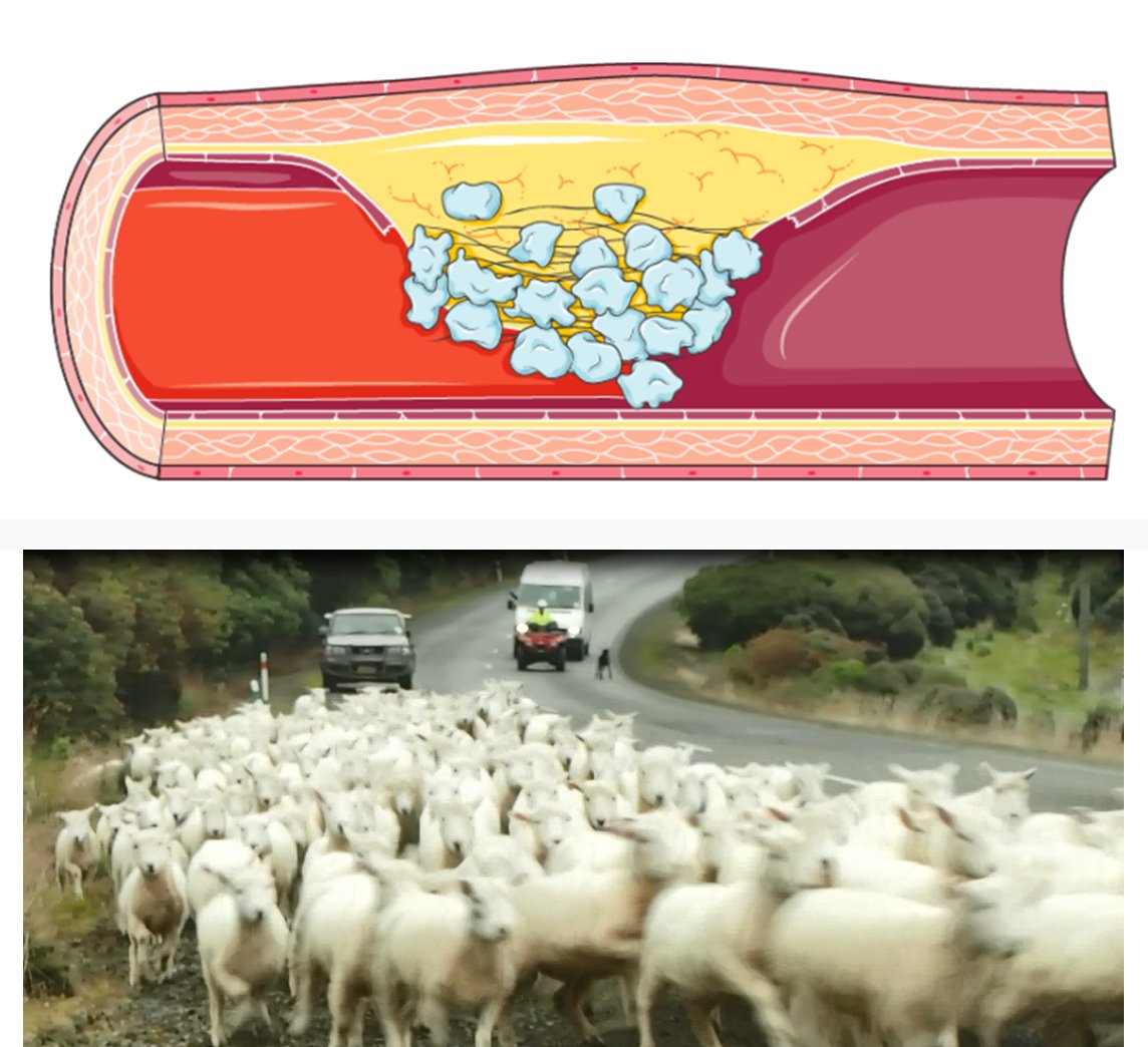  @pintofscienceau  #platelets are important and are like sheep, they stick together to stop  #bleeding when they go rogue : cardiovascular disease  #thrombosis or  #bleeding  #ThisIsMyScience  #OurBody
