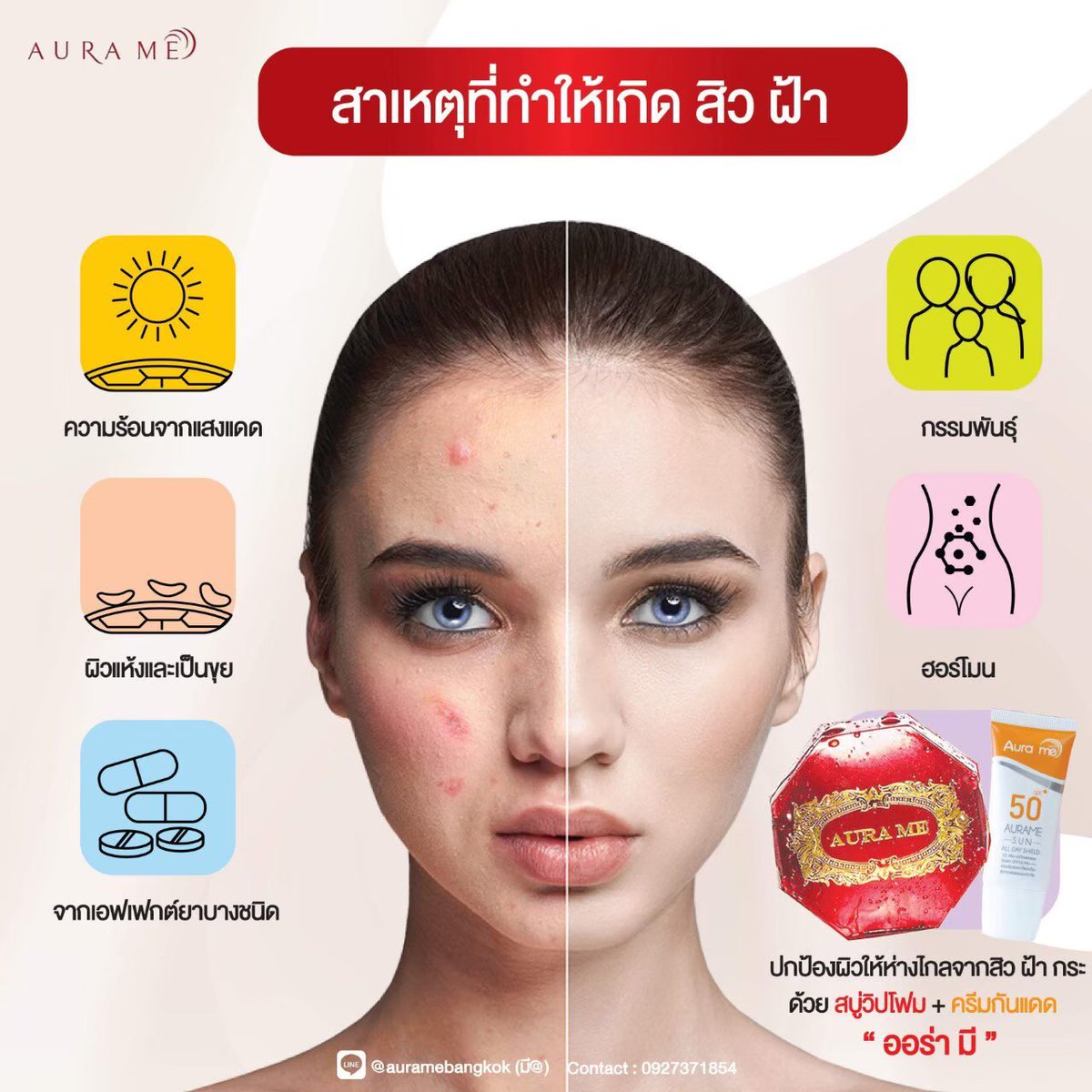 สาเหตุต่างๆรอบตัว ปัจจัยการเกิดสิวฝ้า มีอะไรบ้าง
มาดูกัน
.

#AuraMe #ออร่ามี #ออร่ามีซัน #ครีมกันแดด #กันแดด #กันแดดออร่ามี  #กันแดดผิวแพ้ง่าย #กันแดดผสมรองพื้น #กันแดดผู้ชาย #กันแดดรองพื้น #ซีซีครีม #เครื่องสำอาง #สบู่ลดสิว #สบู่หน้าใส #สบู่วิปมาส์ก #สบู่วิปครีม #สบู่วิปโฟม