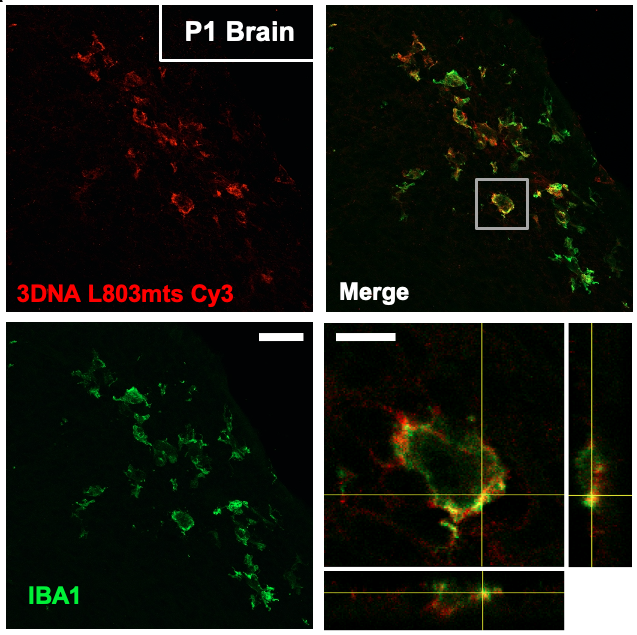 I helped lead the design of an amazing nanoparticle therapy that loves finding its way to microglia – the coolest glia. The 3DNA nanoparticles made by @Gensiphere can deliver therapies to reduce brain injury – exciting stuff!!2/5 https://academic.oup.com/brain/article-abstract/142/12/3806/5607702?redirectedFrom=fulltext