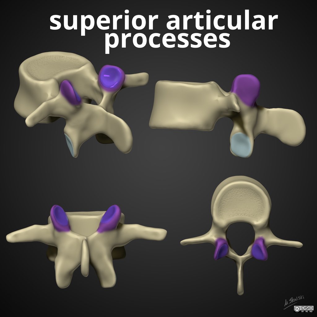 Andrew Dixon (@drandrewdixon) on Twitter photo Radiopaedia’s latest free featured video is <a href="/drcraighacking/">Craig Hacking</a>’s Spine Anatomy lecture. Great illustrations as always by <a href="/docskalski/">M. Skalski</a> 👏
WATCH: Radiopaedia.org/courses/featur…
#radiology #anatomy #spine Radiopaedia’s latest free featured video is <a href="/drcraighacking/">Craig Hacking</a>’s Spine Anatomy lecture. Great illustrations as always by <a href="/docskalski/">M. Skalski</a> 👏
WATCH: Radiopaedia.org/courses/featur…
#radiology #anatomy #spine