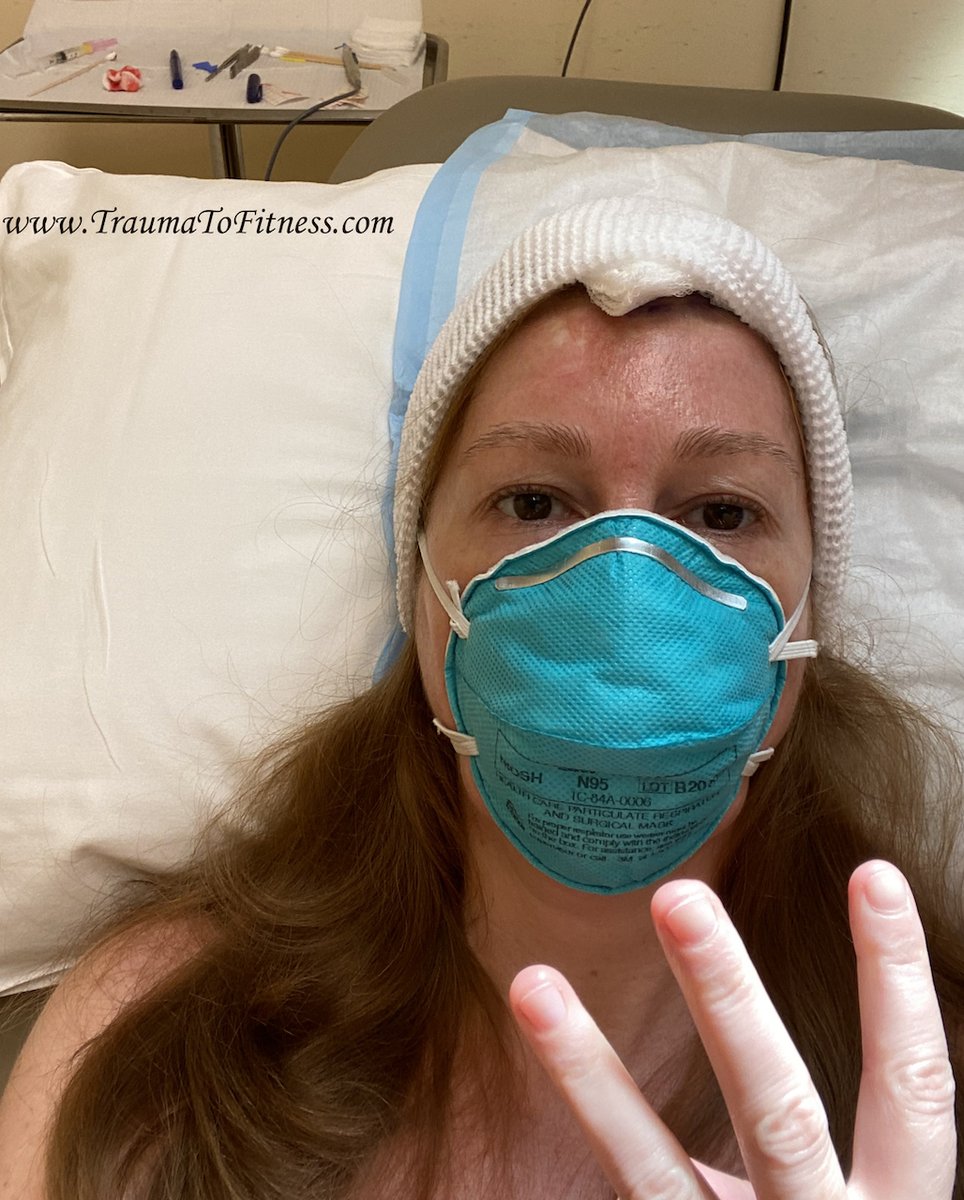PasonActress's tweet photo. #PasonActress #TraumaToFitness #MOHsSurgery #SkinCancerSurgery #SkinCancerSurgeryOnScalp #Redheads #BasalCellSkinCancer #COVID-19 #Writer #Producer #MotivationalSpeaker #PublicSpeaker #Consultant #Health #RegionalAnesthesia #NumbingShot #PreppingForStitches #Health #Cancer https://t.co/auT8pvgQDH