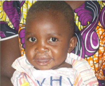 IcFEM D.M. Hospital (@icfemdmh) on Twitter photo Ryan's life has been drastically changes thanks to successful cleft lip & palate surgeries in Nov and March! There have been 78 other patients like him with us over the past year. Thank you <a href="/SmileTrainAfric/">Smile Train Africa</a> <a href="/Smiletrain/">Smile Train</a> . #MotivationMonday #Thankful Ryan's life has been drastically changes thanks to successful cleft lip & palate surgeries in Nov and March! There have been 78 other patients like him with us over the past year. Thank you <a href="/SmileTrainAfric/">Smile Train Africa</a> <a href="/Smiletrain/">Smile Train</a> . #MotivationMonday #Thankful