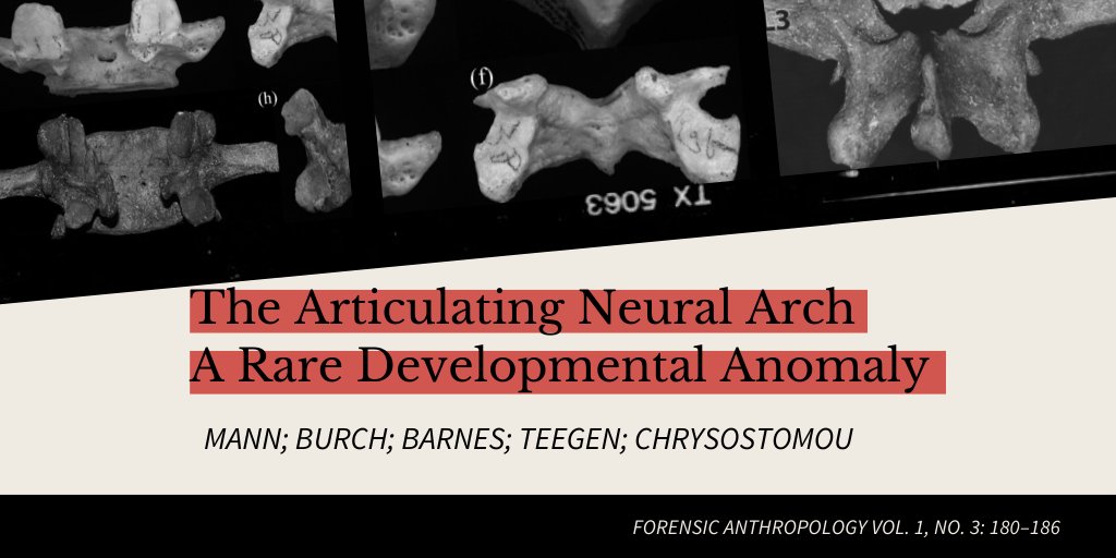 JForensicAnth's tweet photo. Read Mann & colleagues' take on faceted articulating neural arches, a rare developmental #anomaly. The authors discuss how the anomaly can assist #medicolegal specialists in establishing the identity of human remains #FAjournal #vertebrae #vertebralcolumn https://t.co/gDBqJ3dCcY https://t.co/4m8k8Fu2Pb