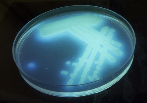 A DANISH specialist in healthcare and human-centric #lighting has claimed a breakthrough after it successfully killed 99.99 per cent of bacteria in 10 minutes using a #light fitted with UV-C #LEDs. buff.ly/2VNHLSw