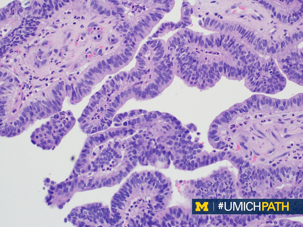 Michigan Pathology tweet media