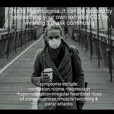 “Continual” mask wearing is, of course, not defined in any of these dysinfo memes. Are we talking about a 20 min trip to Costco? Or a 9 hr surgical procedure where surgeon, anesthetist and nurses all wear masks throughout? Guess what? Neither case leads to hypercapnia. 7/