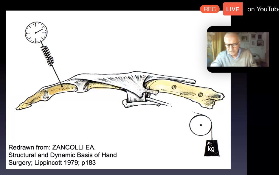 vikram_devaraj's tweet photo. Outstanding level of experience, knowledge & passion shared tonight by colleague & friend Donald Sammut with superb webinar. 25 years in I have learned so much👌🏽@BSSHand #DerbyTeaching @Pulvertafthands https://t.co/kalDwT5MfQ