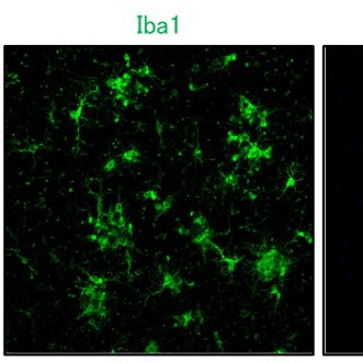 WakoChemicalsUS's tweet photo. Anti Iba1, Goat is now available! 20% discount for orders placed directly with Wako in May. No promo code needed. Catalog number 011-27991, 100uL. Offer not valid for distributors or resellers #microglia #iba1 #neuroscience https://t.co/9OIscET841