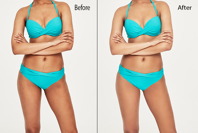 clippingpathsin's tweet photo. Professional body retouching helps to improve your photos and look like so gorgeous.
Try it now: https://t.co/0lLMaPWNfr
#photos #retouching #photoretouching #bodyretouching #photography #photographers #professionalphotographer https://t.co/XVKNc9Kqgp