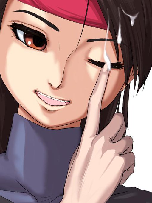 なやみすぎて腕がミイラなんだが…!? 