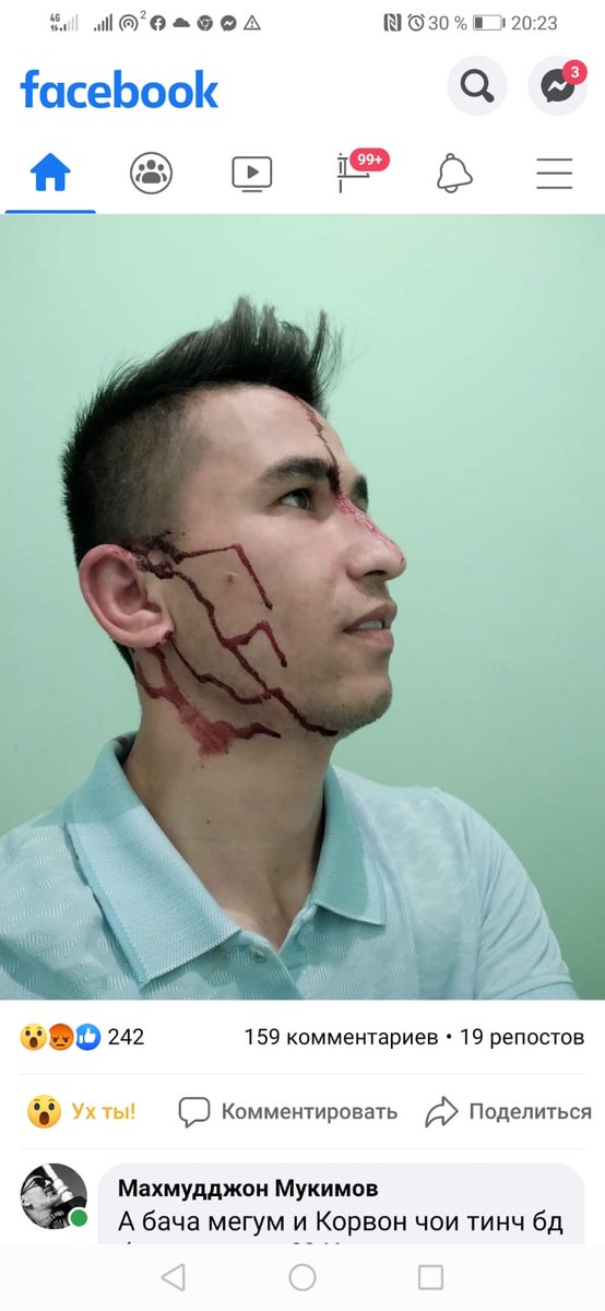 steveswerdlow's tweet photo. Just finished talk on #humanrights in #Tajikistan during #COVID19 & learn that a journalist known for independent reporting on pandemic is violently attacked-#AbdulloGurbati-reporter for @AsiaPlusTJ-was beaten up by 2 assailants tonight near his home in #Dushanbe-Now hospitalized https://t.co/TPT7Lid14W