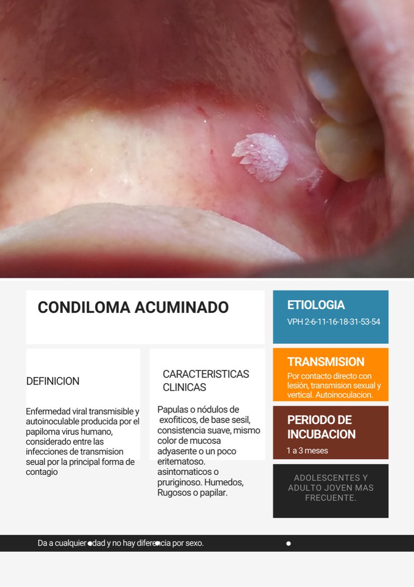 Manifestările cutanate ale infecţiei cu virusul papiloma uman Virus papiloma condiloma acuminado